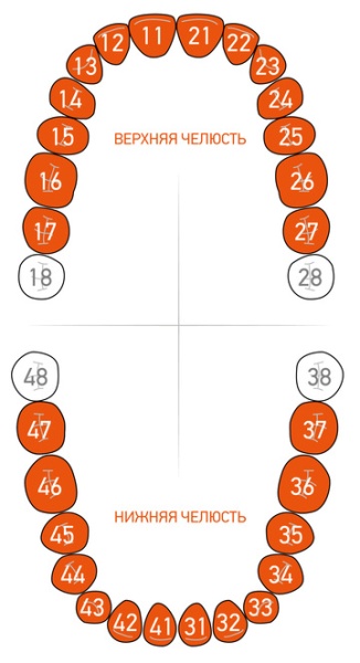 Кламп-сепаратор Elliot Separator Dentech (Япония) 215